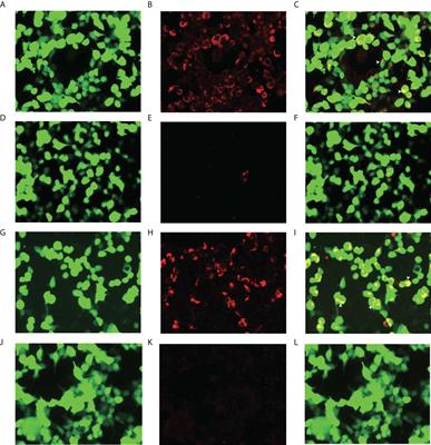 Case report: Revealing a special and rare autoimmune GFAP astrocytopathy in the spinal cord succeeding Neurobrucellosis infection